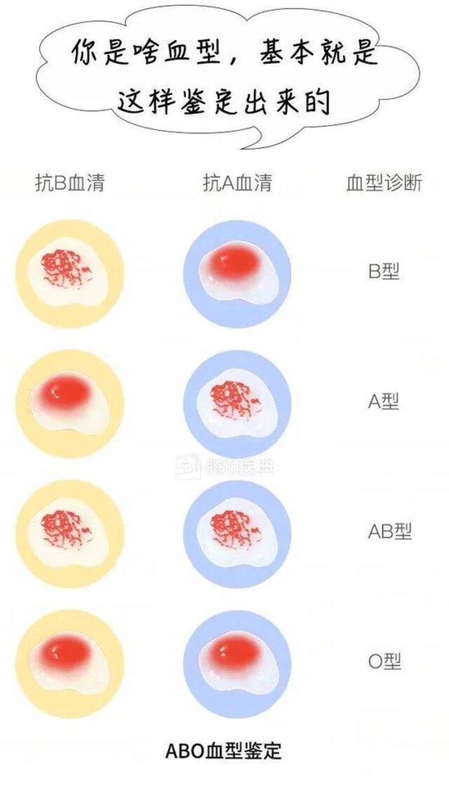 来源：腾讯医典