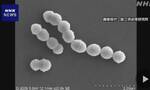 日本“食人菌”感染病例超1100例