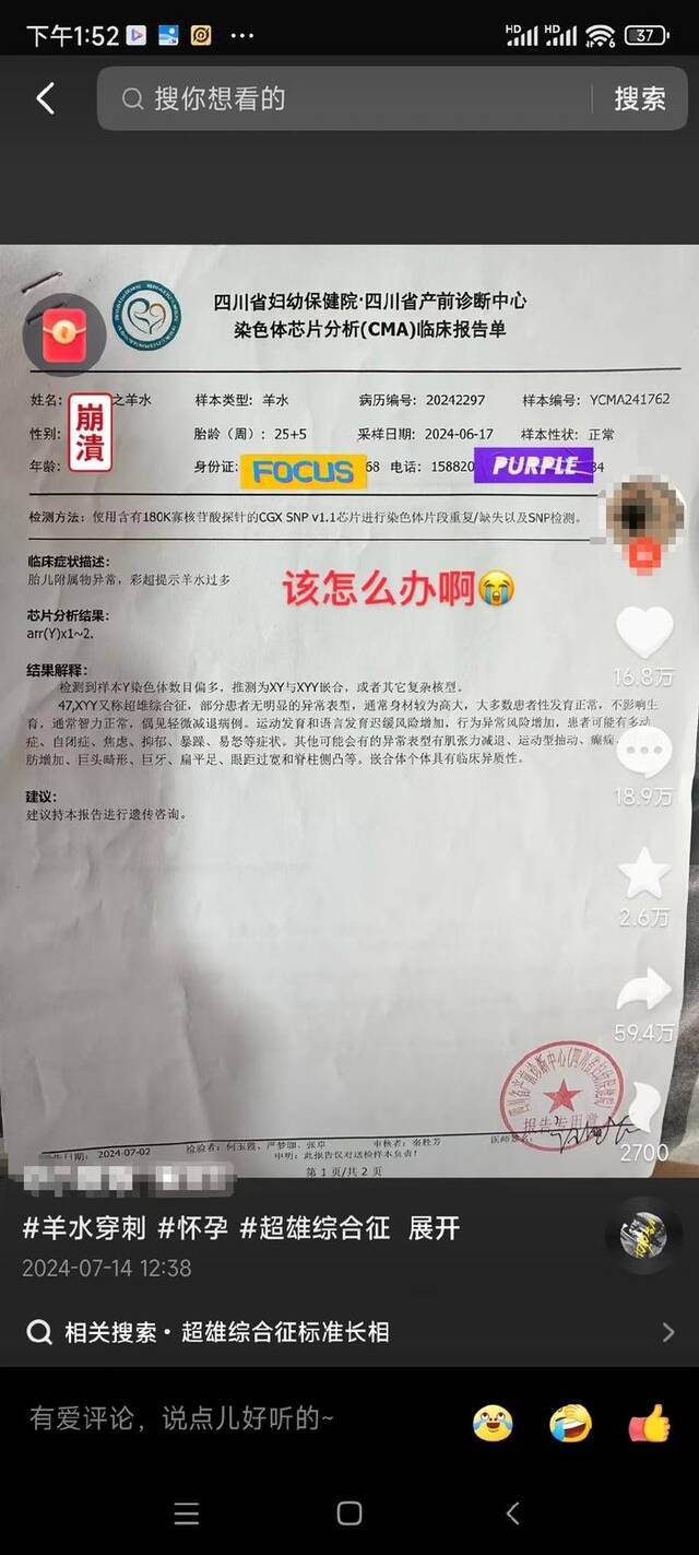 专家：“吃掉兄弟”“犯罪基因”都是对“超雄综合征”误解