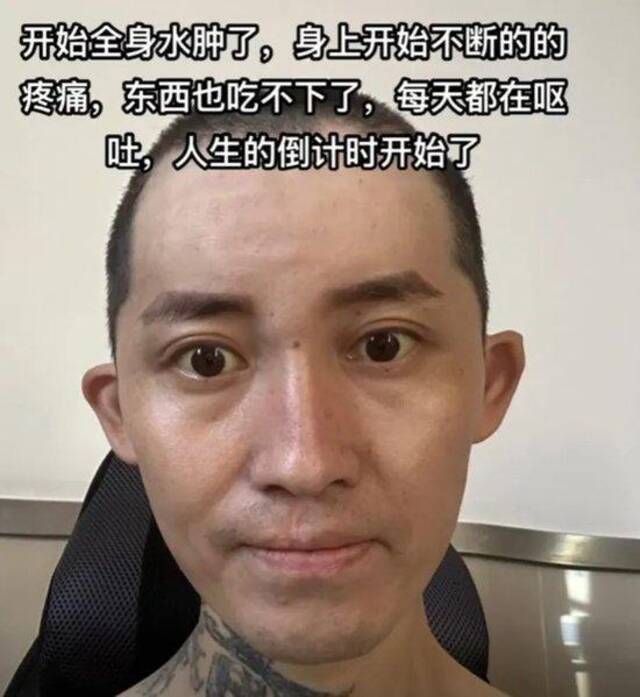 贵州29岁抗癌网红大飞去世，4年前罹患肝癌晚期，村民证实：去世当天被运回家乡