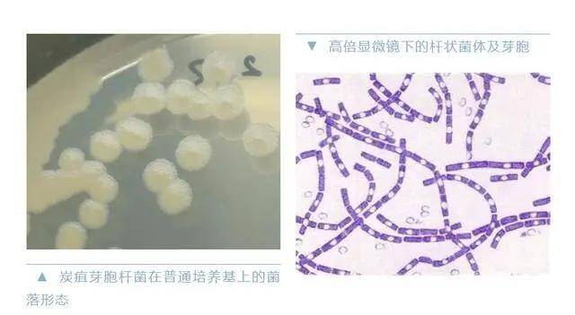 ▲图片来源：中国疾控中心官方微信号截图